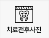 치료전후사진