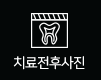 치료전후사진
