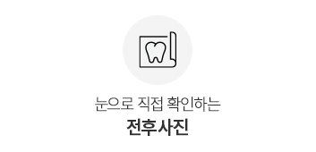 전후사진